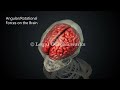 Car Accident with TBI Injury 3D Animation