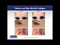 webinar biocell collagen® joint skin and connective tissue health* now foods january 2019