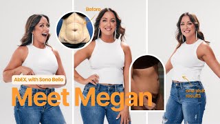 Why AbEX Was the Best Decision for My Body Confidence