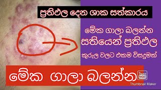 කුරුලෑ කරදරයට Best හොදම විසදුම -  How To Remove Pimples -  Acne Treatment @ Home