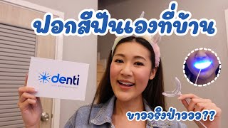 Denti Teeth Whitening รีวิว ฟันขาวจริงหรอ? เสียวฟันมั๊ย? | EP.21