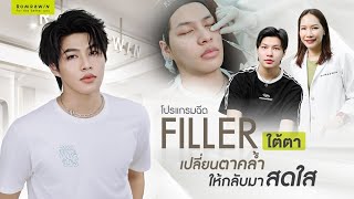 Juvederm | จัดการปัญหาใต้ตาคล้ำ ถุงใต้ตาของคุณแทค | Filler