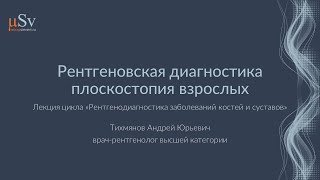 Рентгеновская диагностика плоскостопия взрослых