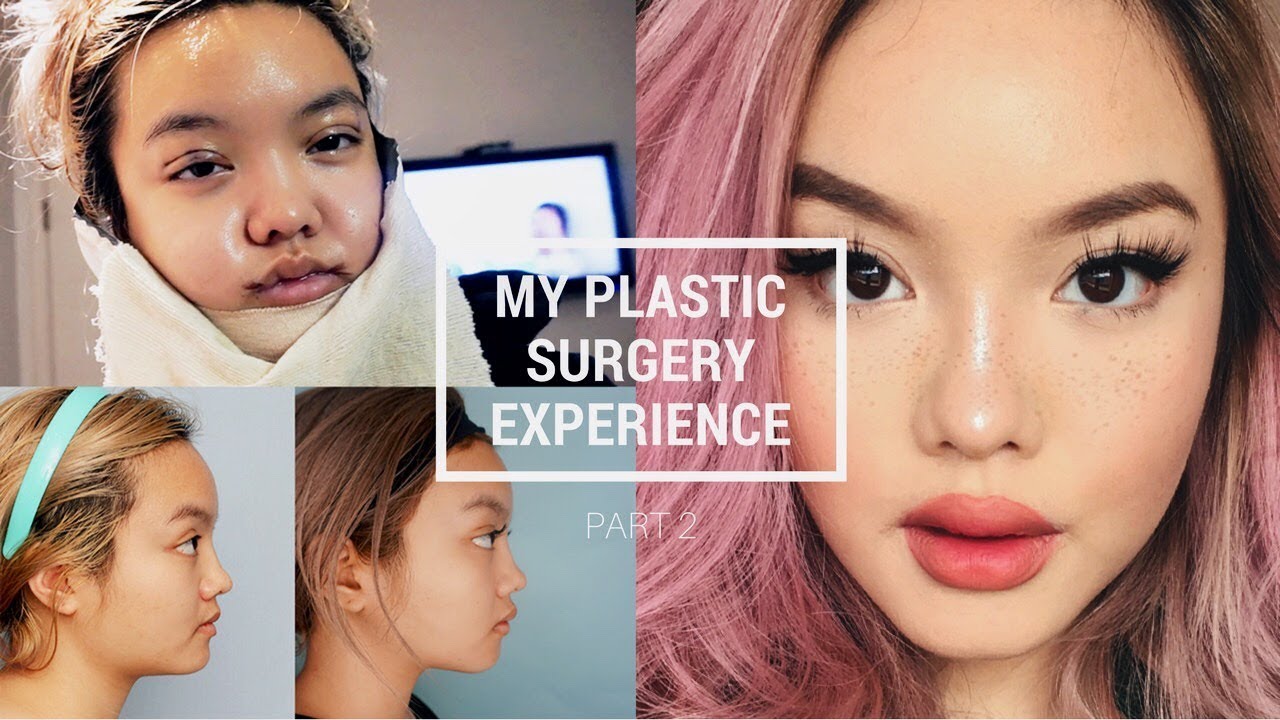 PLASTIC SURGERY IN KOREA: PT. 2 [RECOVERY + RESULTS] - YouTube