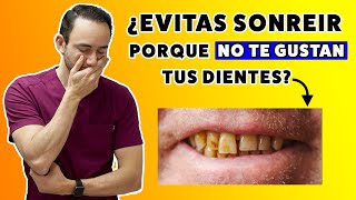 ¿Tu sonrisa te da pena? ¿Evitas sonreír para que no vean tus dientes?