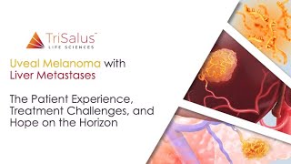 Uveal Melanoma with Liver Metastases: Patient Experience, Treatment Challenges \u0026 Hope on the Horizon