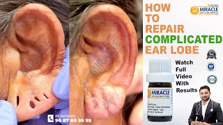 कान का बड़ा छेद कैसे ठीक करे / How To Repair Big Ear Hole / Ear Lobe Treatment /#bestearpasting