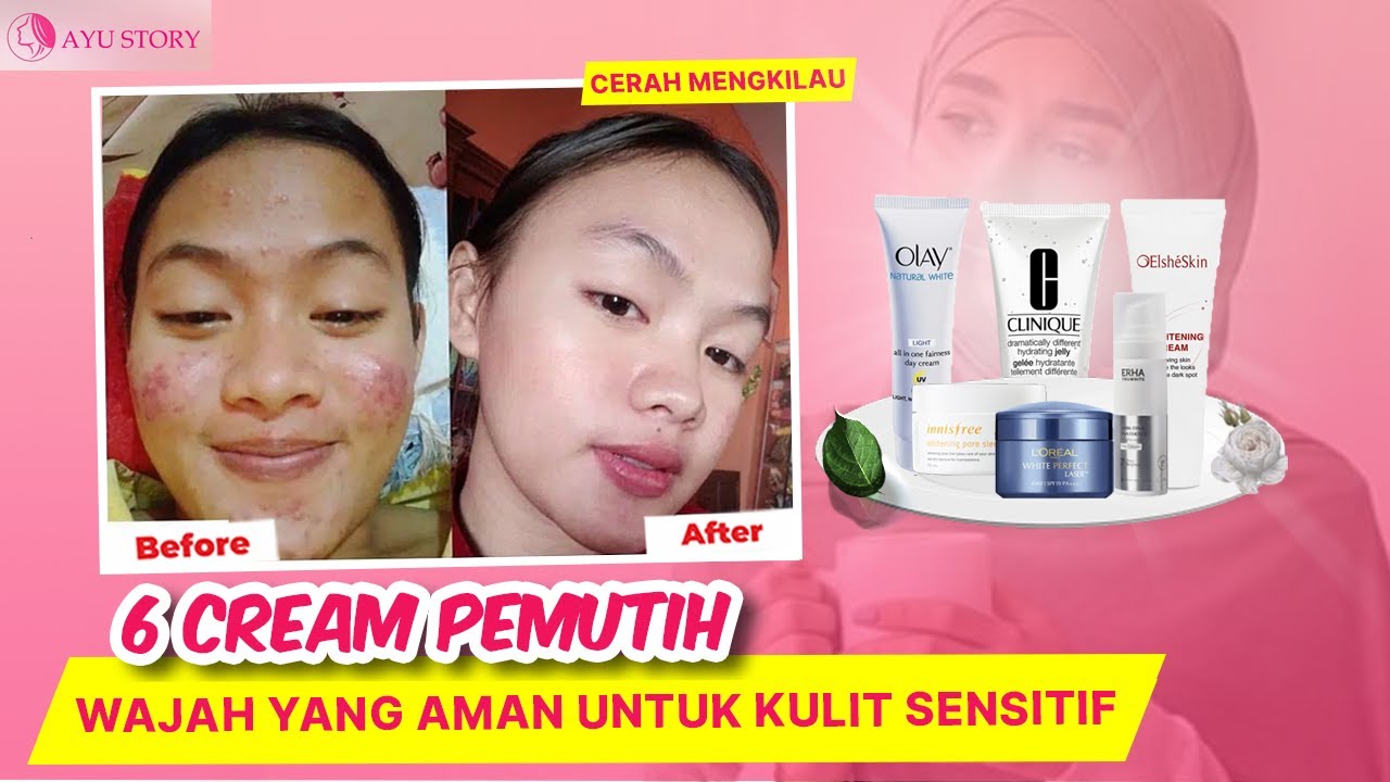 6 REKOMENDASI CREAM PEMUTIH WAJAH YANG AMAN UNTUK KULIT SENSITIF - YouTube