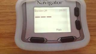 Abbott FreeStyle Navigator CGM Calibration