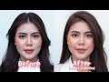 review ยกกระชับหน้าด้วย ultraformer iii botox filler จัดหนักจัดเต็มต้อนรับปีเสือ 🐯✨ blossom clinic