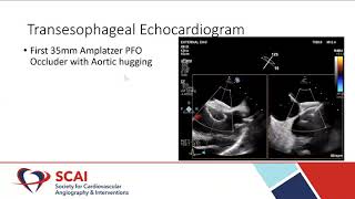 Hypoxia After LVAD Implantation