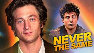 Jeremy Allen White Was Never The Same After Shameless