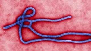 Ebola defense options: Quarantine, isolation and self-monitoring