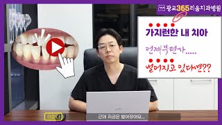 수원치과, 심미치료, 예전엔 분명 가지런했는데 점점 치아가 벌어진다구요? 원인과 치료법 미리 알아두세요!