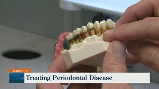 Troy Family Dental: Periodontal disease