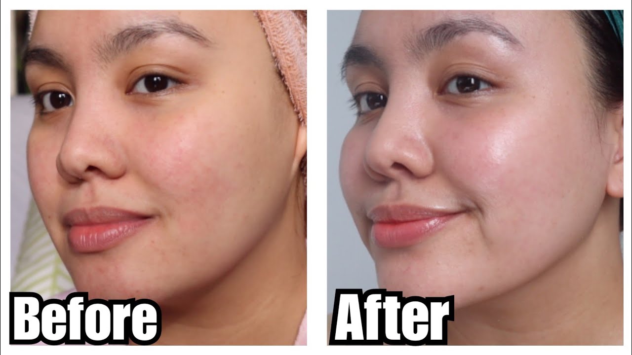 Korean Skincare Routine Before And After Gl Skincare Routine