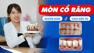 Mòn Cổ Răng - Nguyên Nhân \u0026 Cách Điều Trị | Nam Bùi Vinalign