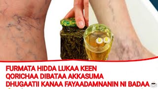 Furmata Hidda Lukaa  Keena Qorichaa Dibataa Akkasuma Dhugaatii Faaadamnanini ni Badaa