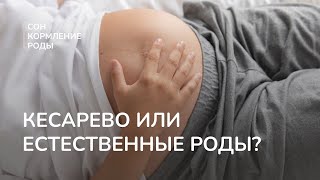 Кесарево или естественные роды?