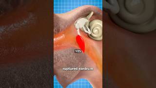 Can Holding In A Sneeze Hurt You? 😨 Surgeon Reacts