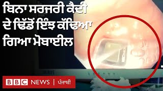 Mobile in Abdomen: Doctors ਨੇ ਕੈਦੀ ਦੇ ਢਿੱਡ ਵਿੱਚੋਂ Mobile Phone ਬਿਨਾਂ Surgery ਦੇ ਕੱਢਿਆ | 𝐁𝐁𝐂 𝐏𝐔𝐍𝐉𝐀𝐁𝐈