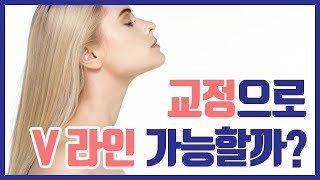 치아 교정으로 브이라인 될 수 있나요?