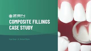 [Zen Dental] Case Study: Composite Fillings 1 | Dentist in Seattle, Washington 98102