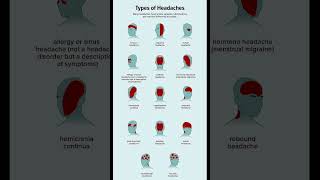 Types of headache 🤕 #doyouknow 🫵🏻⁉️#headache #trending