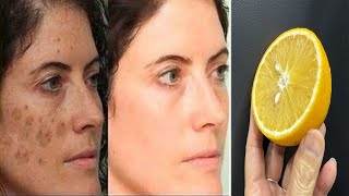 100 year-old Recipe - Remove Sagging Skin, Fade Dark Spots and Glowing Skin!