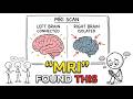 Science Proves: Social Isolation Shrinks Your Brain