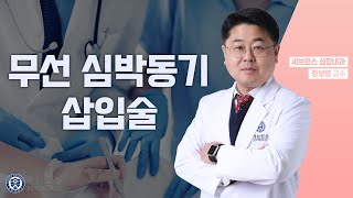 무선 심박동기 삽입술