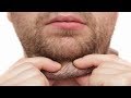 How To Get Rid of Double Chin - Double Chin Removal Cream - Remove Sagging Jawline How To Get Rid of Double Chin - Double Chin Removal Cream - Remove Sagging Jawline