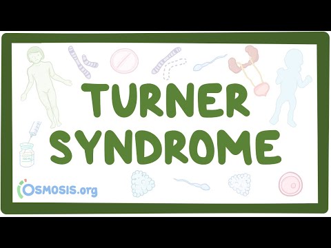 What chromosomal mutation causes Turner syndrome?