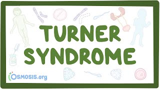 Turner syndrome (Year of the Zebra)