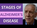 Alzheimer's Stages: What are the Stages of Alzheimer's Disease Nursing NCLEX