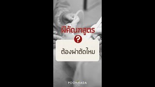 ฝีคัณฑสูตร ต้องผ่าตัดไหม???