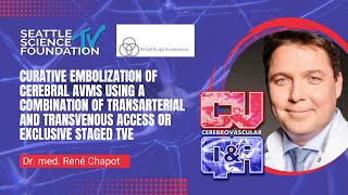 Curative Embolization of Cerebral AVMs - Dr. med René Chapot