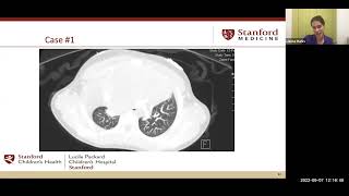 Diagnosing Pediatric Cancers for the Primary Care Provider (Recording)