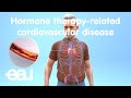 ADT (hormone therapy) related cardiovascular disease