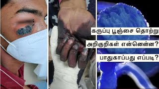 கருப்பு பூஞ்சை தொற்று அறிகுறிகள் என்னென்ன ? தொற்றிலிருந்து பாதுகாப்பது எப்படி? Black Fungal Disease