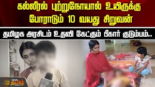 கல்லீரல் புற்றுநோயால் உயிருக்கு போராடும் 10 வயது சிறுவன்..   | Child Liver Disease | sivagangai