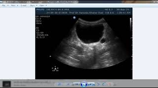 Record 2024 09 30 Prof Dr Hamada Khater BEST ULTRASOUND AND DOPPLER CASES