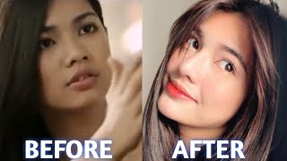 JANE DE LEON BEFORE AND AFTER!!