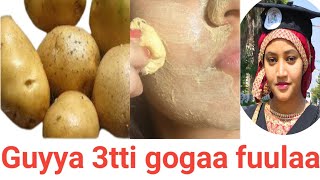 Guyyaa 3 kessati fuula keenya barechuuf Removing dark spot on face in 3 days