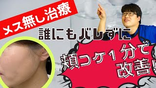 【SBC静岡院】山本院長解説★誰にもバレずに頬コケ改善！ヒアルロン酸注入でやつれた顔も若々しい印象に！！