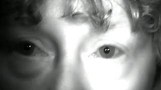Intermittent Square Wave Jerks [ARCHIVE]