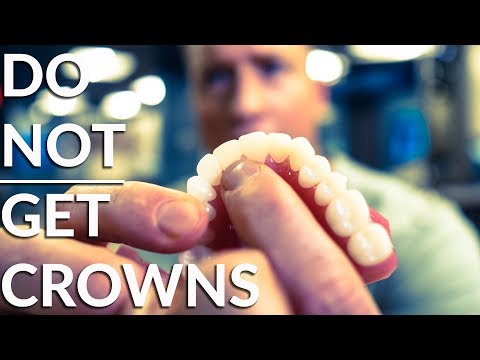 Do NOT crown your teeth! - Must watch before dental work! Do NOT crown your teeth! - Must watch before dental work!