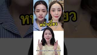 จ่ายเท่าไหร่เปลี่ยนแค่ไหน???EP.11 #ศัลยกรรมเกาหลี #AeySurgery