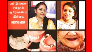 No Tooth No Health | பல வகையான செயற்கை பற்கள் | Dr Gayathri Sathya