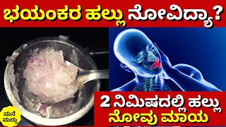 ಭಯಂಕರ ಹಲ್ಲು ನೋವಿದ್ಯಾ? | 2 ನಿಮಿಷದಲ್ಲಿ ಹಲ್ಲು ನೋವು ಮಾಯ | Home remedy for teeth pain | hallu novu